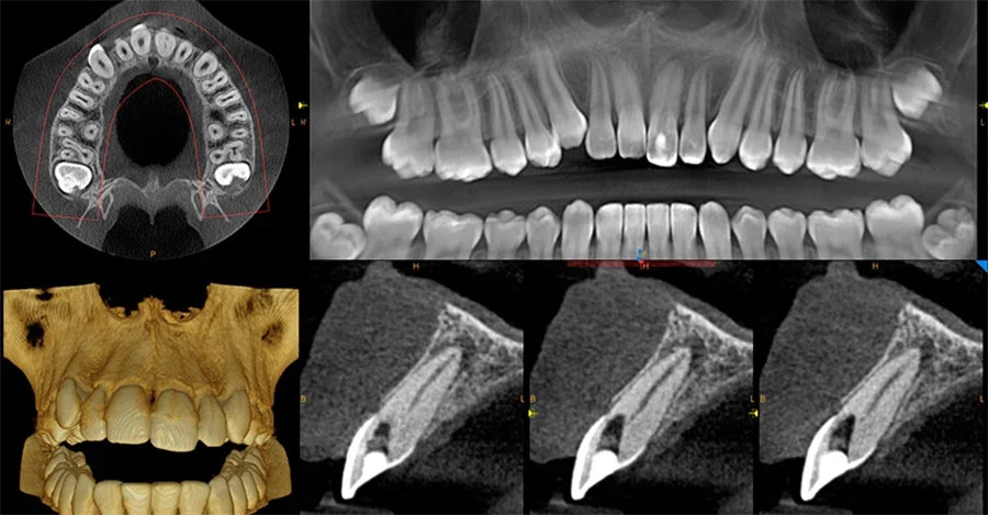 CBCT Dental Scanning in Wyke – Bradford Dental Clinic